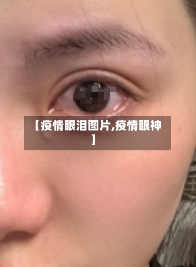 【疫情眼泪图片,疫情眼神】-第1张图片