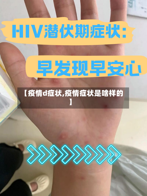 【疫情d症状,疫情症状是啥样的】-第1张图片