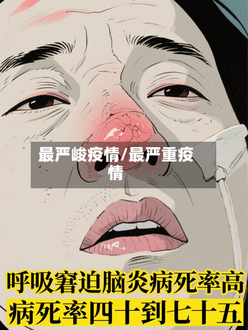 最严峻疫情/最严重疫情-第2张图片