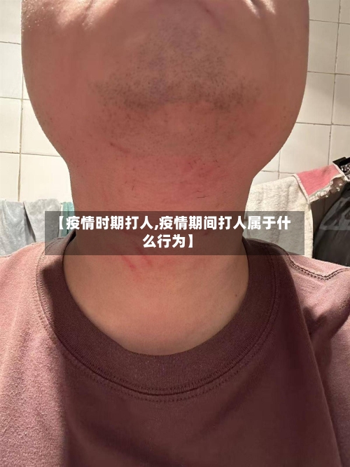 【疫情时期打人,疫情期间打人属于什么行为】-第1张图片