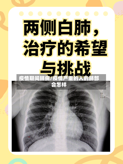 疫情期间肺病/疫情严重的人的肺部会怎样