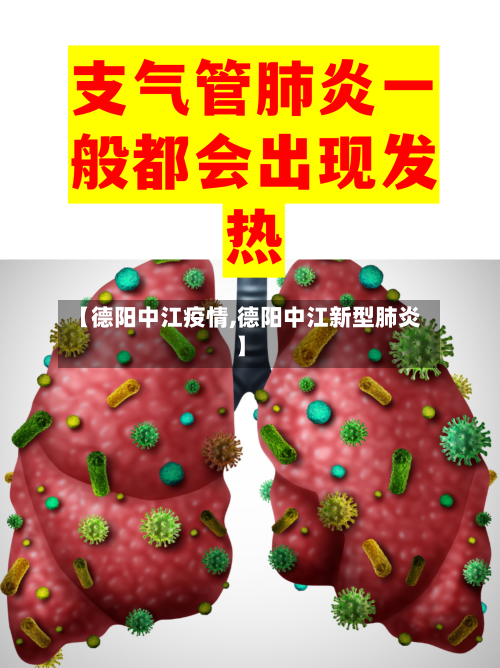 【德阳中江疫情,德阳中江新型肺炎】-第2张图片