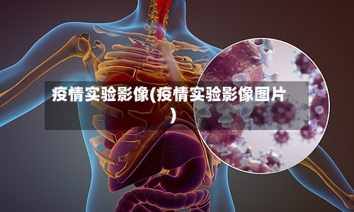疫情实验影像(疫情实验影像图片)-第2张图片