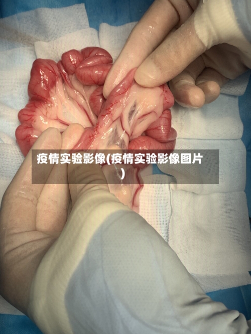 疫情实验影像(疫情实验影像图片)-第3张图片