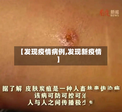 【发现疫情病例,发现新疫情】-第1张图片