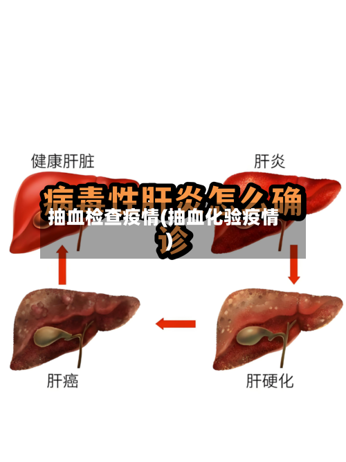 抽血检查疫情(抽血化验疫情)-第1张图片