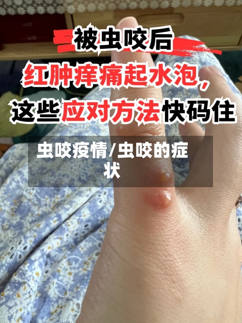 虫咬疫情/虫咬的症状-第2张图片